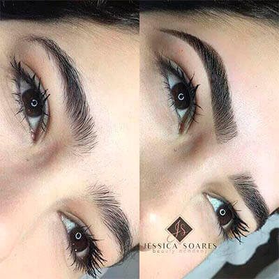 antes e depois